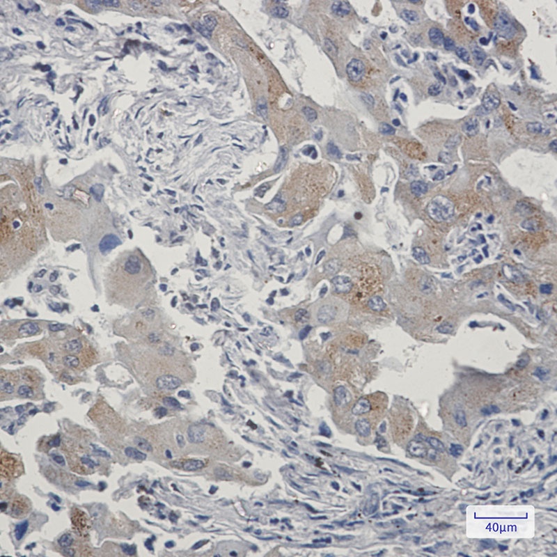 TAX1BP1 Rabbit mAb