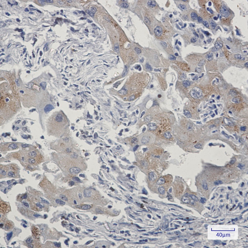 TAX1BP1 Antibody