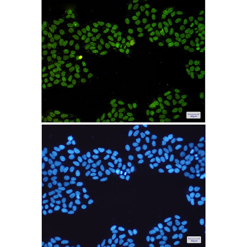 TOP1 Antibody