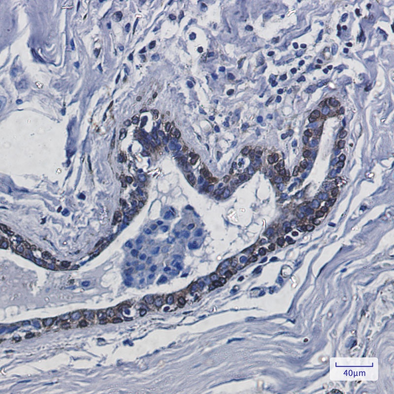 Transmembrane Protein 43 Rabbit mAb