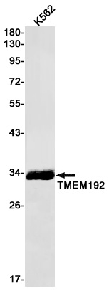 TMEM192 Rabbit Monoclonal Antibody