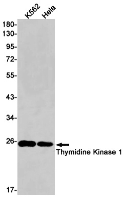 TK1 Rabbit Monoclonal Antibody