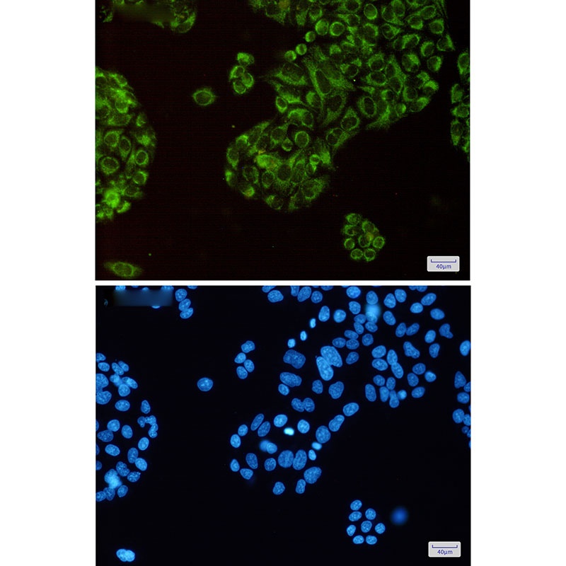 Thioredoxin 2 Rabbit mAb