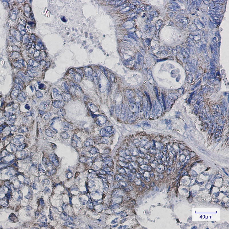 Thioredoxin 2 Rabbit mAb
