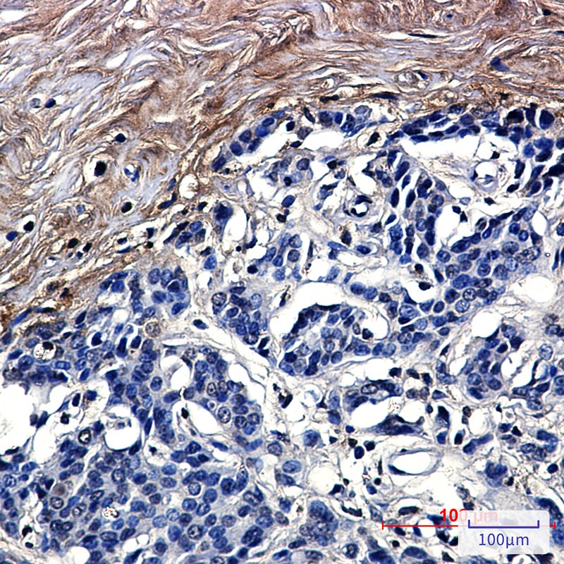 Tetranectin Rabbit mAb