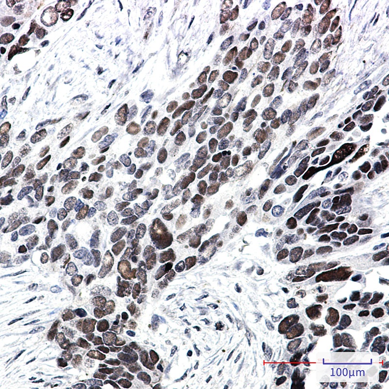 TCF7L2 Antibody