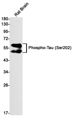 Phospho-Tau (Ser202) Rabbit mAb