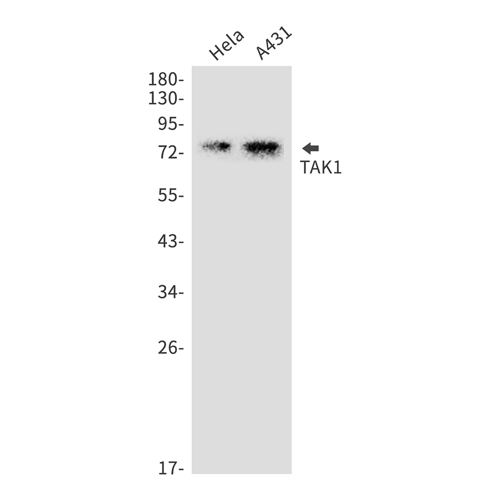 MAP3K7 Antibody