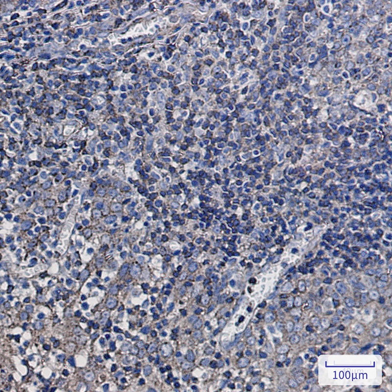 Synaptophysin Like Protein 1 Rabbit mAb