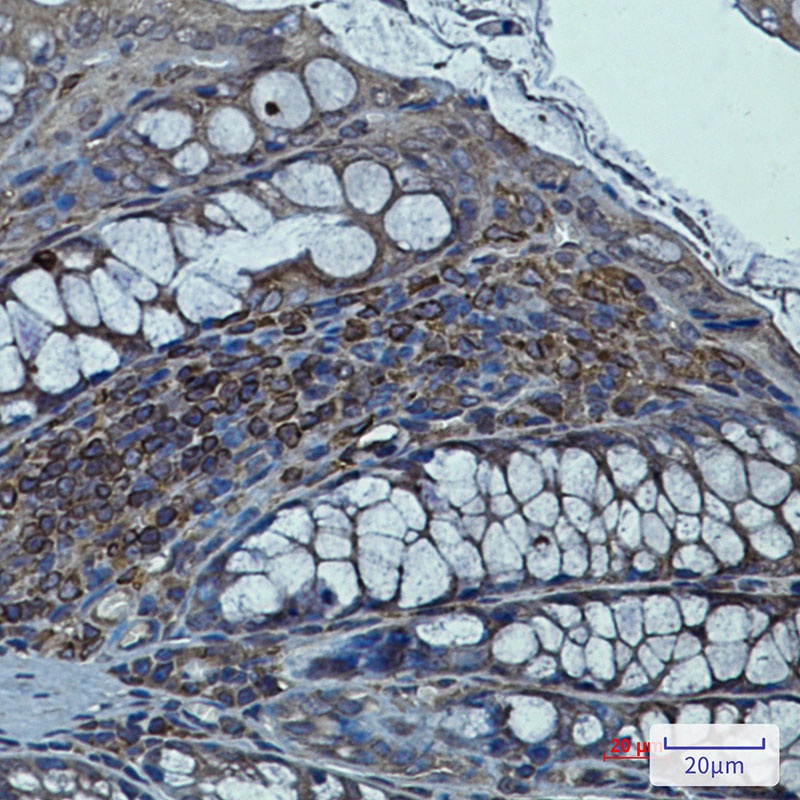 Syntrophin alpha 1 Rabbit mAb