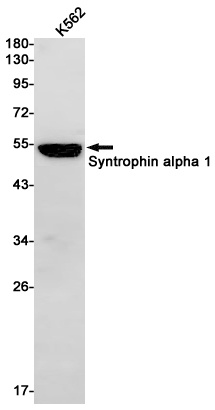 Syntrophin alpha 1 Rabbit mAb