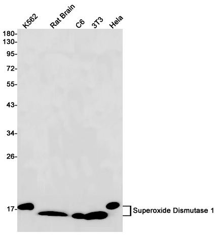Superoxide Dismutase 1 Rabbit mAb