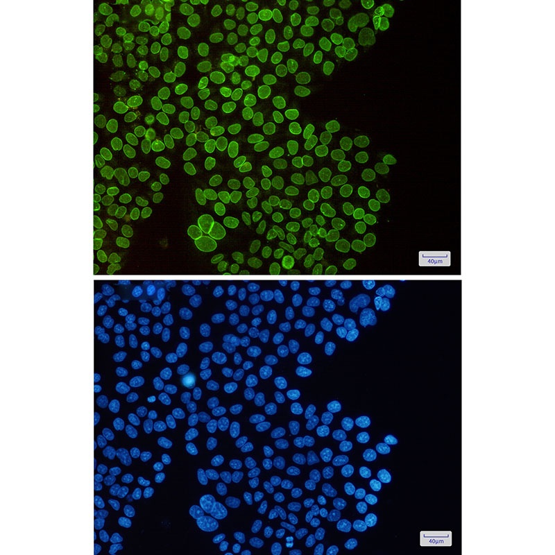 SUN1 Antibody