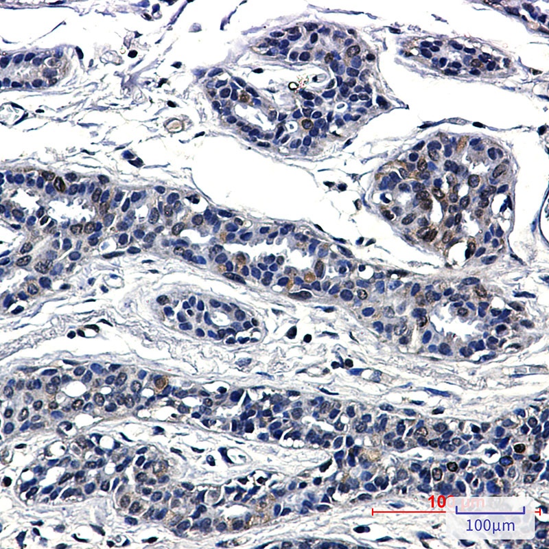 SUN1 Antibody