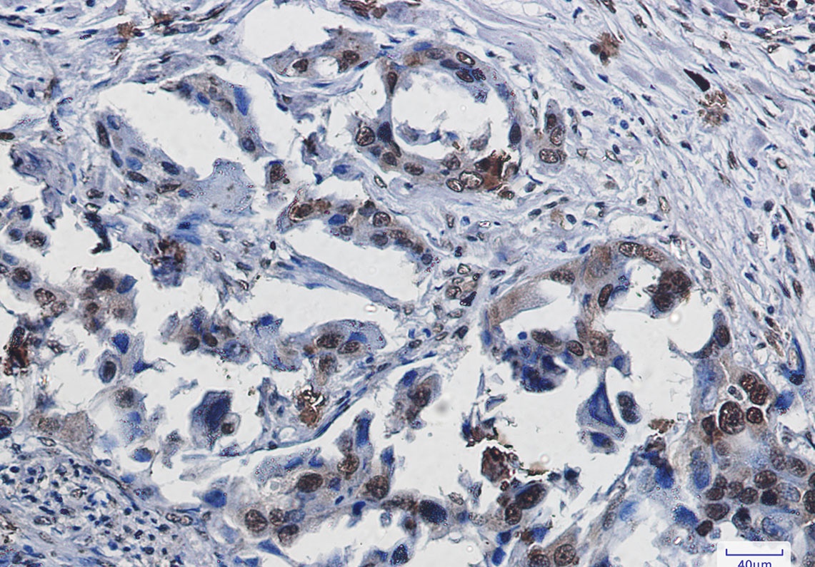 SUMO1 Rabbit Monoclonal Antibody