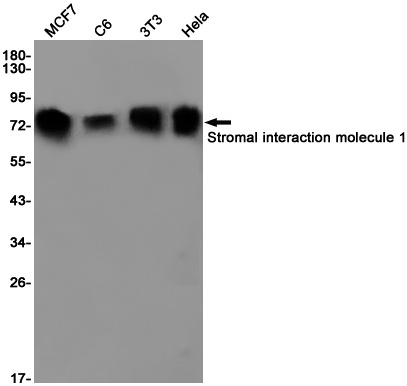 Stromal Interaction Molecule 1 Rabbit Monoclonal Antibody