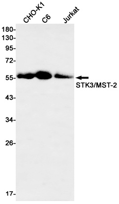 STK3 Rabbit mAb