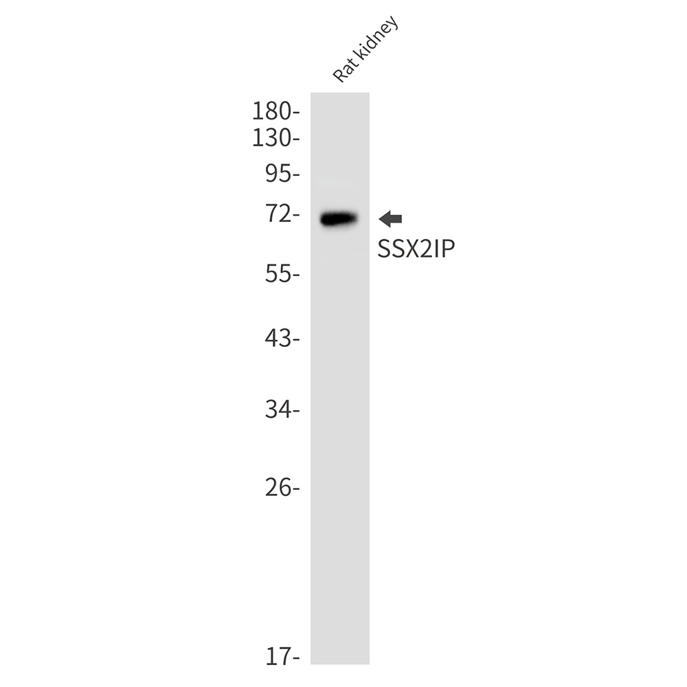 SSX2IP Antibody