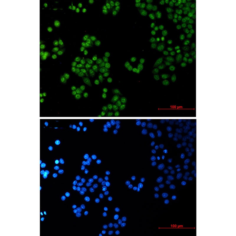 SP1 Antibody