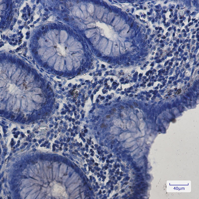 SP1 Antibody