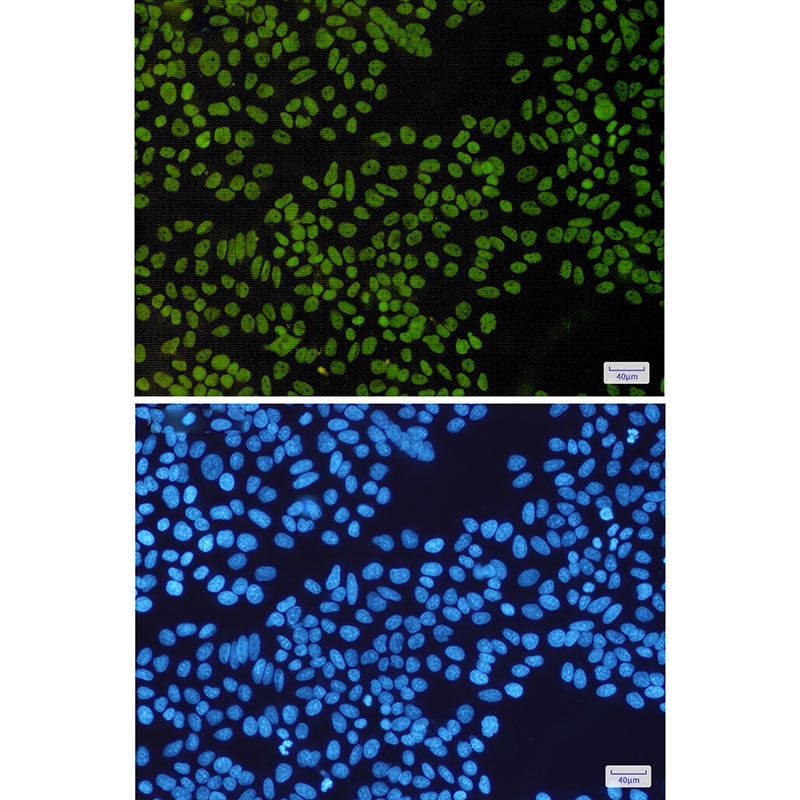 SMARCB1 Rabbit mAb