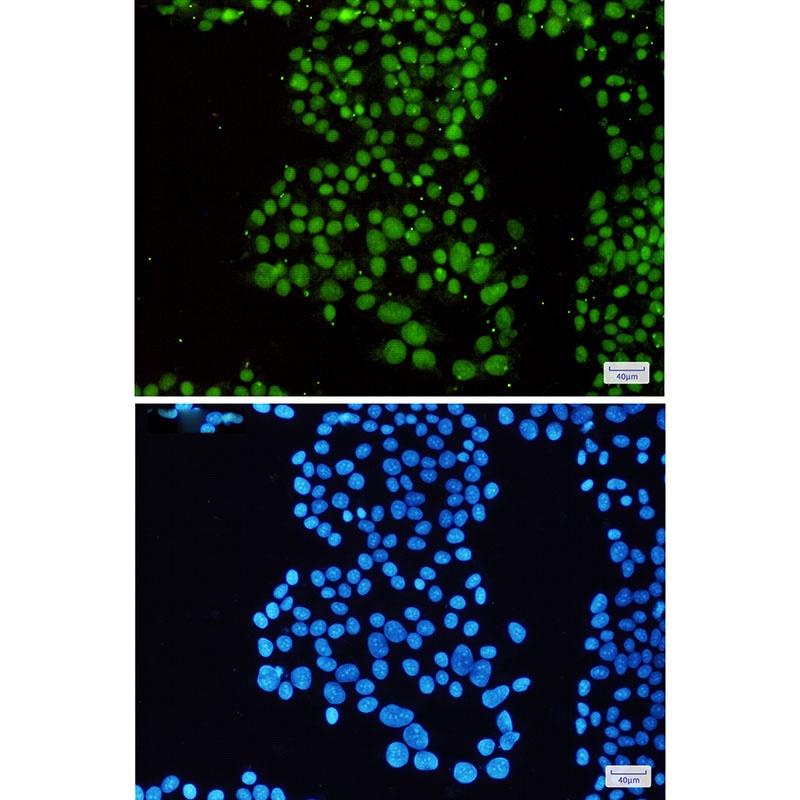 SMARCB1 Rabbit mAb