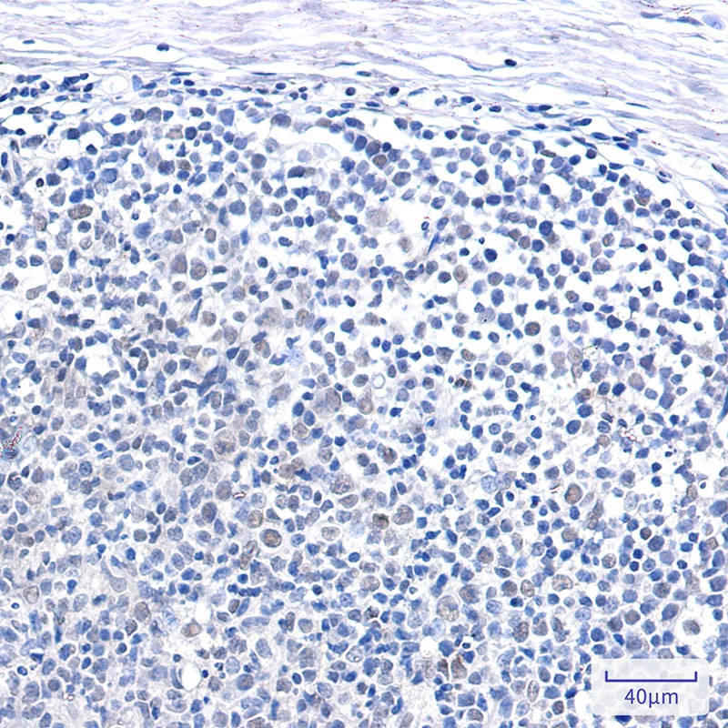 SMARCB1 Rabbit mAb