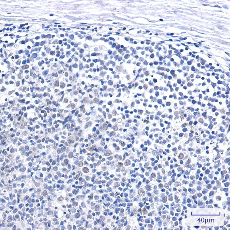 SMARCB1 Antibody