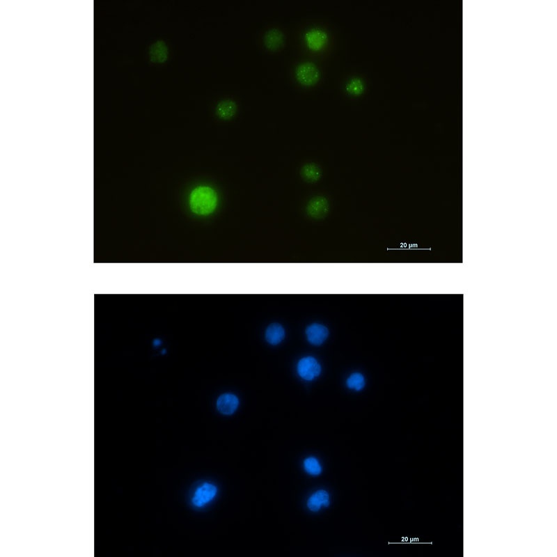 SMARCA5 Antibody
