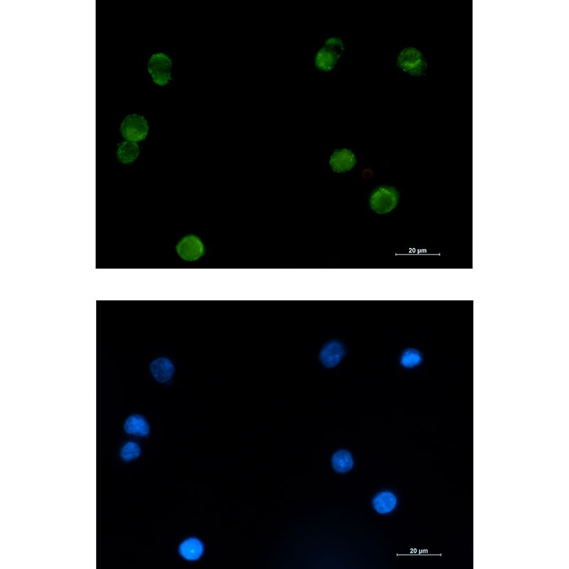 SMYD3 Antibody