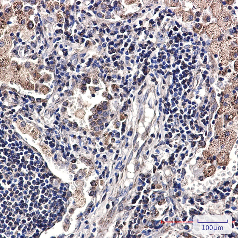 SMYD3 Antibody