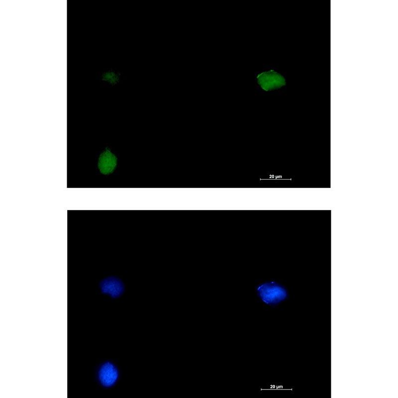 SMARCC1 Antibody