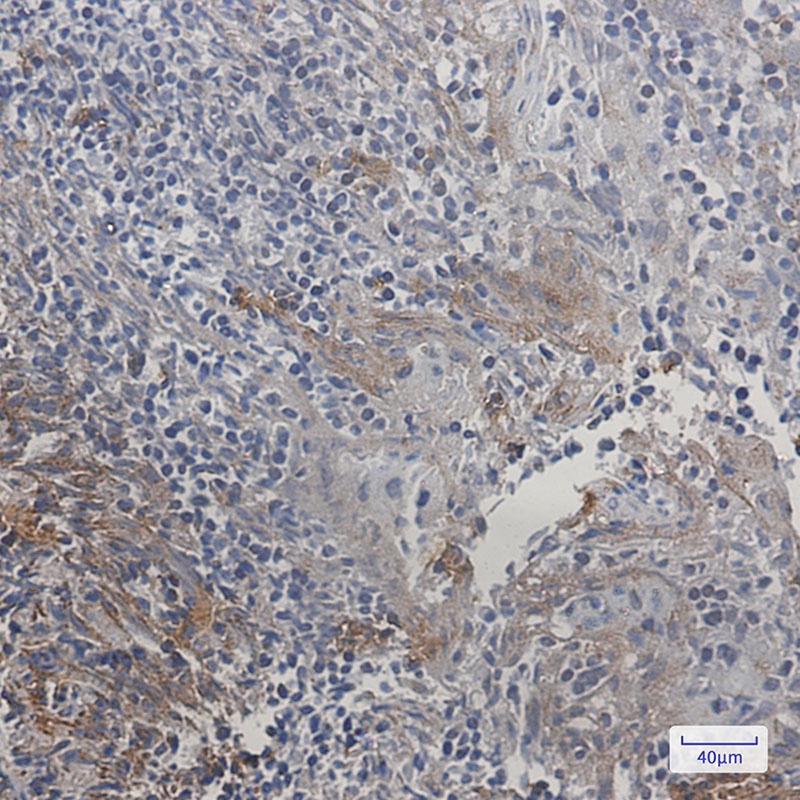DIABLO Antibody
