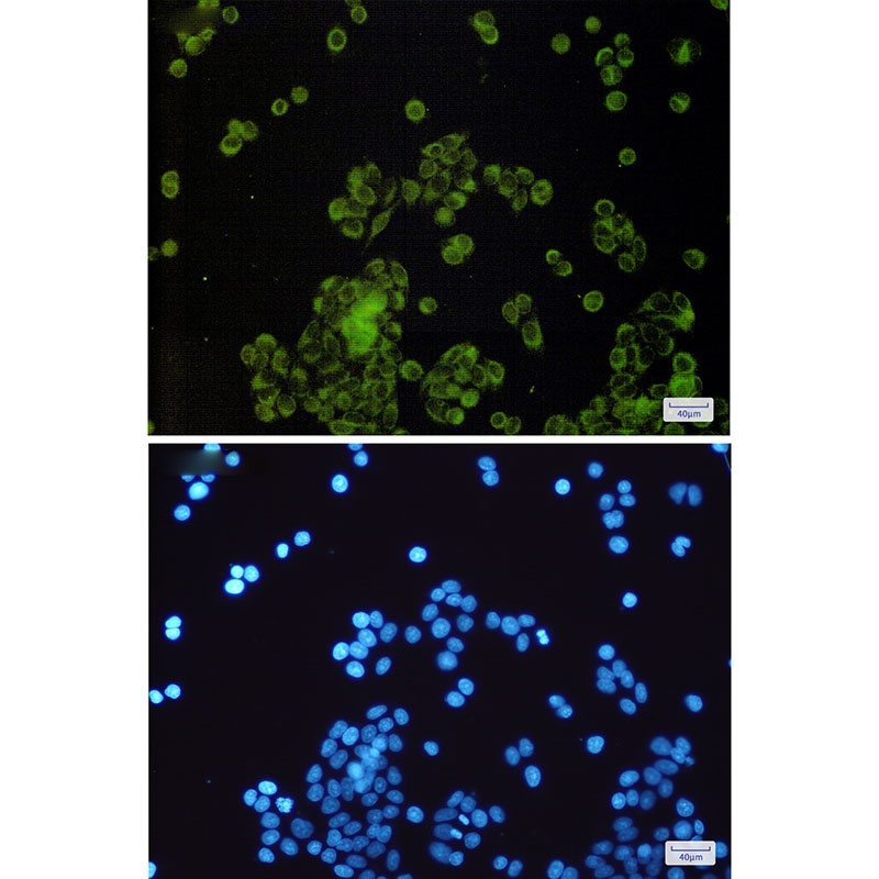 SLC27A4 Rabbit mAb