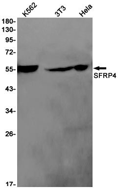 SFRP4 Rabbit mAb