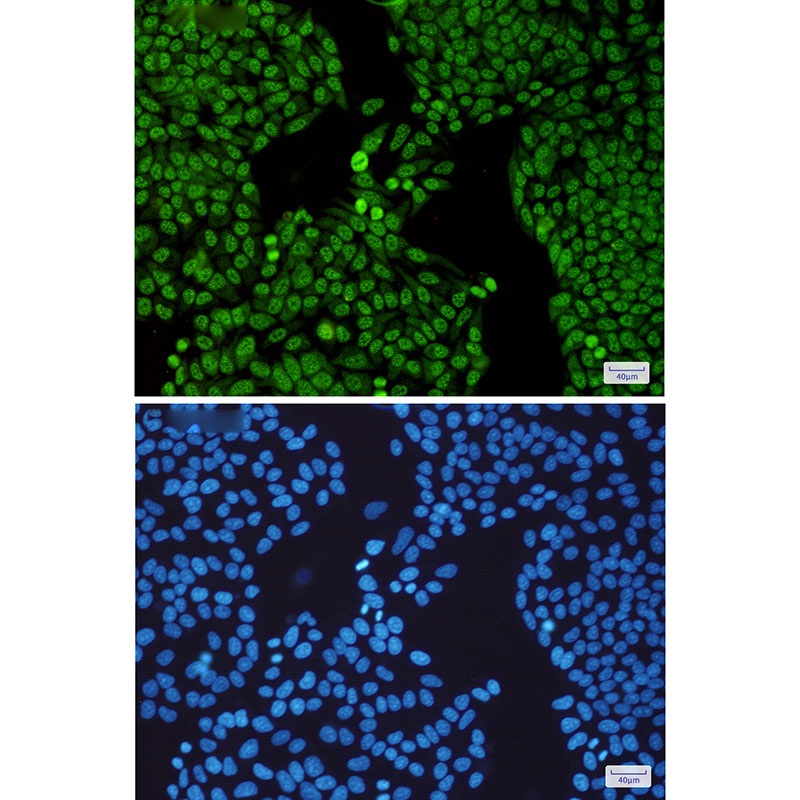 SF3B3 Rabbit mAb