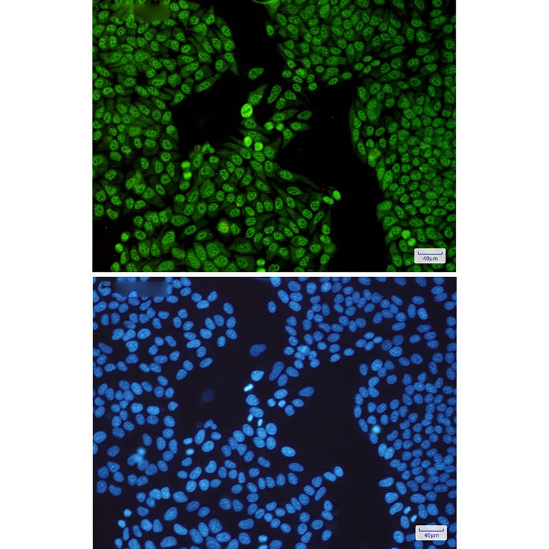 SF3B3 Antibody