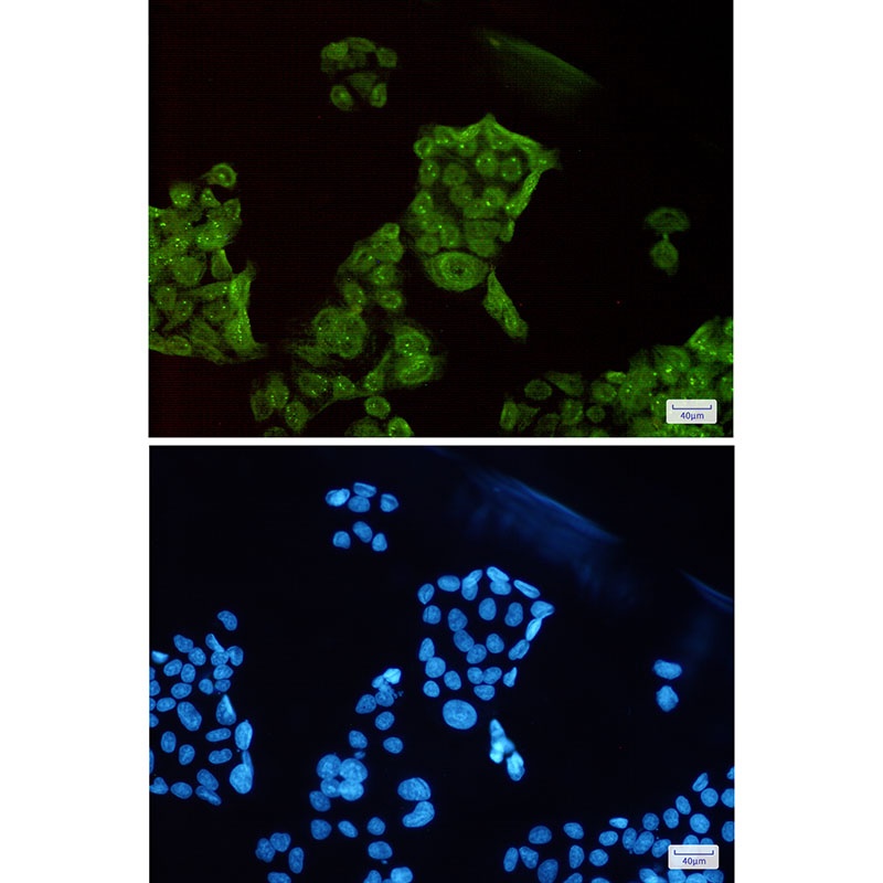SET Rabbit mAb