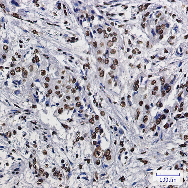 SET Rabbit mAb
