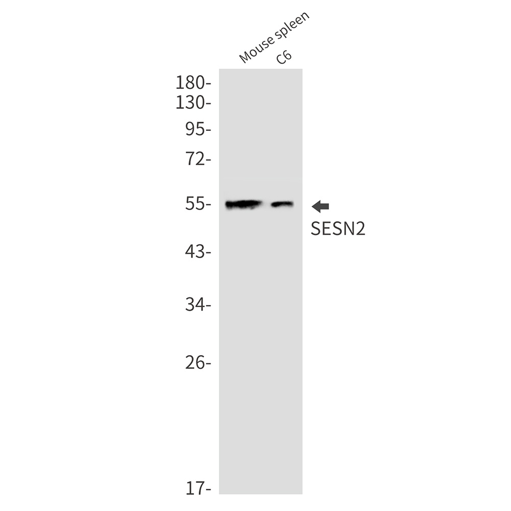 SESN2 Rabbit mAb