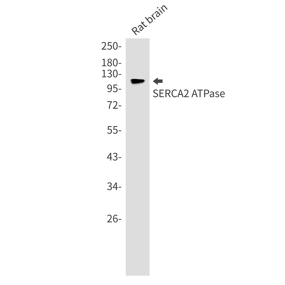 ATP2A2 Antibody