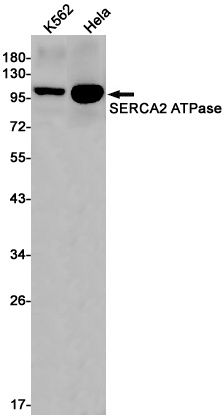 ATP2A2 Antibody