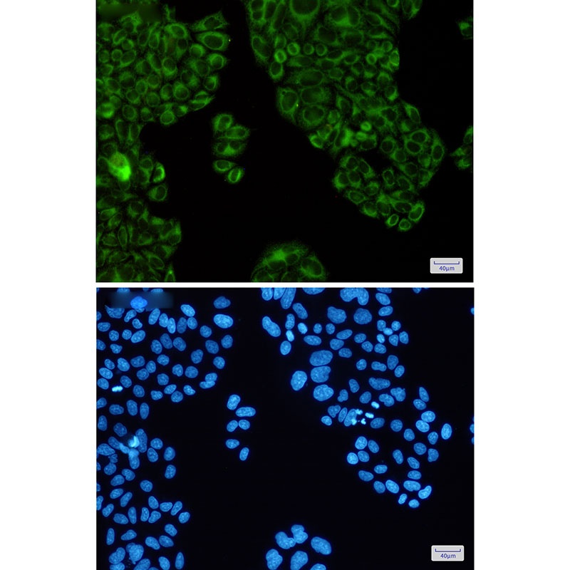 ATP2A2 Antibody