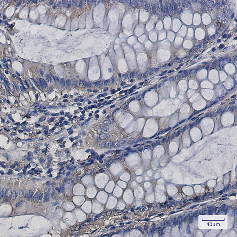 ATP2A2 Antibody