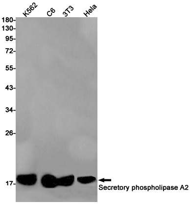 PLA2G2A Rabbit Monoclonal Antibody