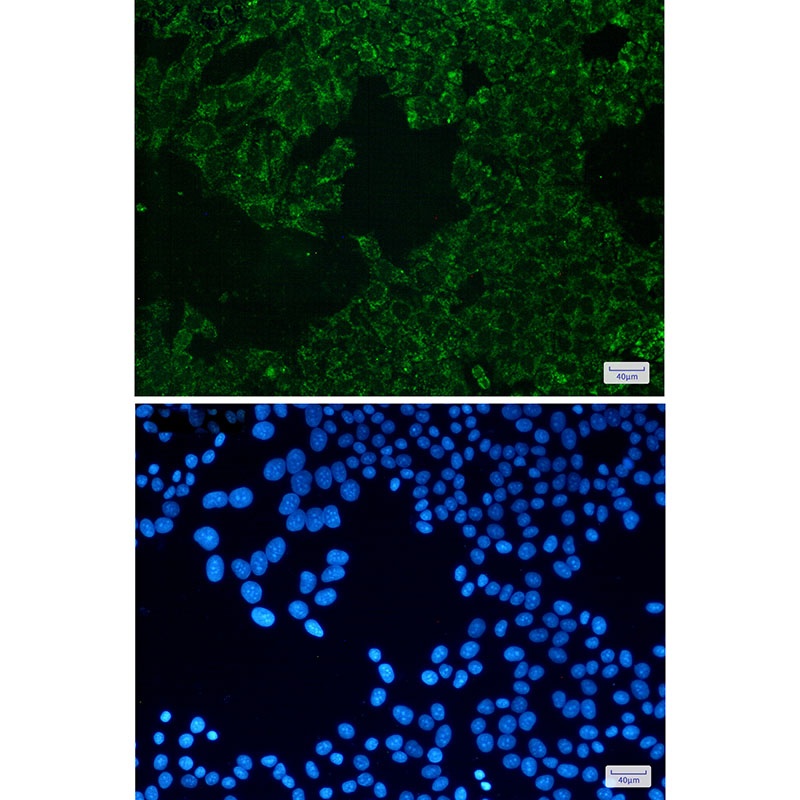 SEC61A Rabbit mAb