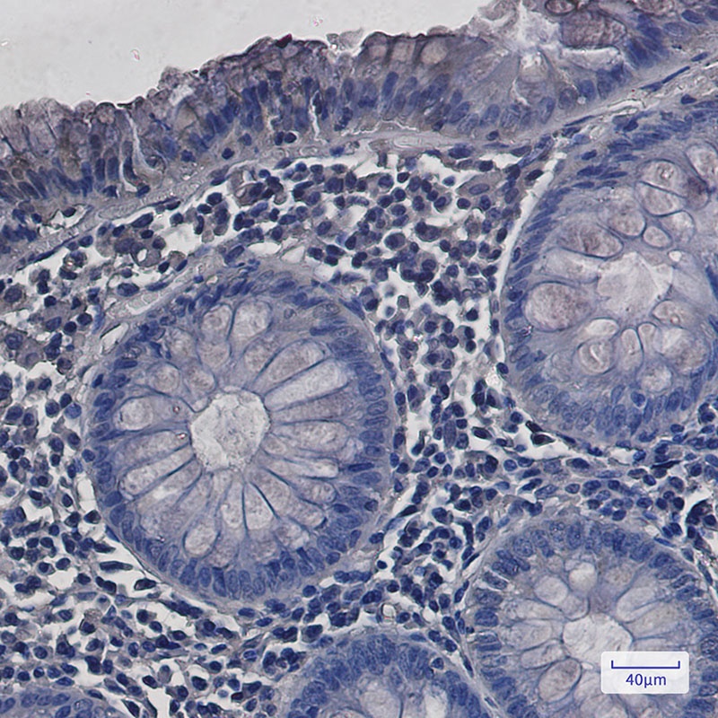 SDHA Rabbit mAb