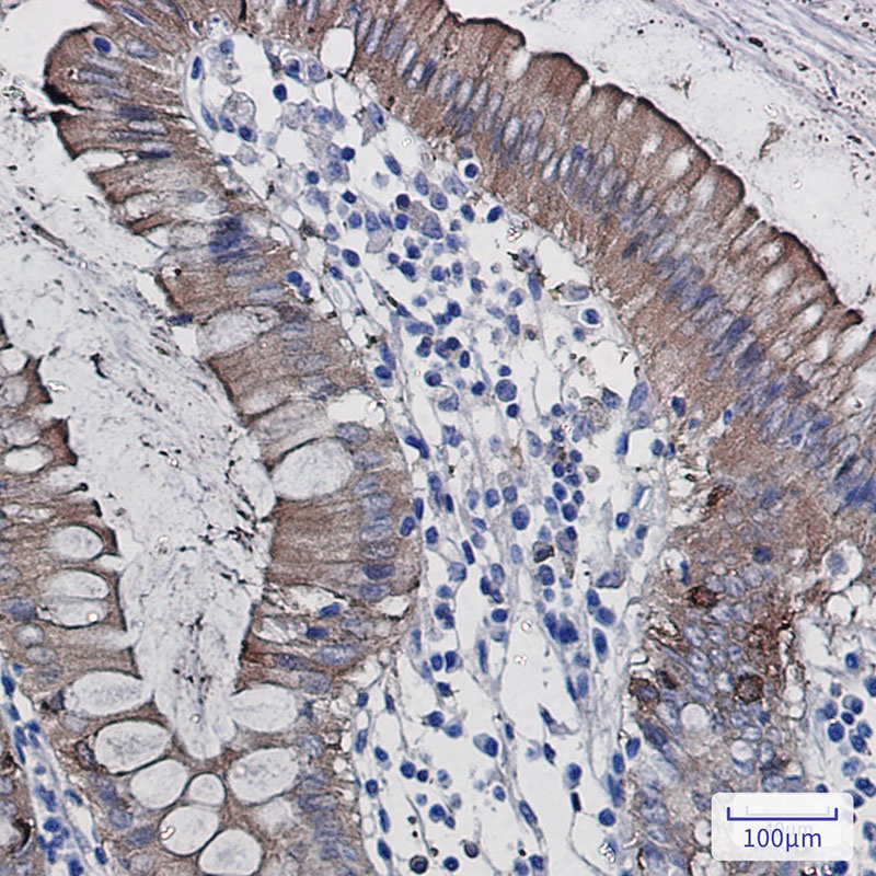 SCIN Rabbit mAb