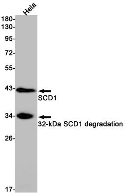 SCD Antibody