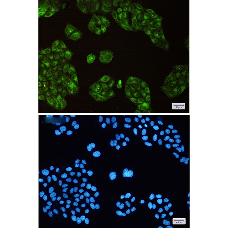 SCD Antibody